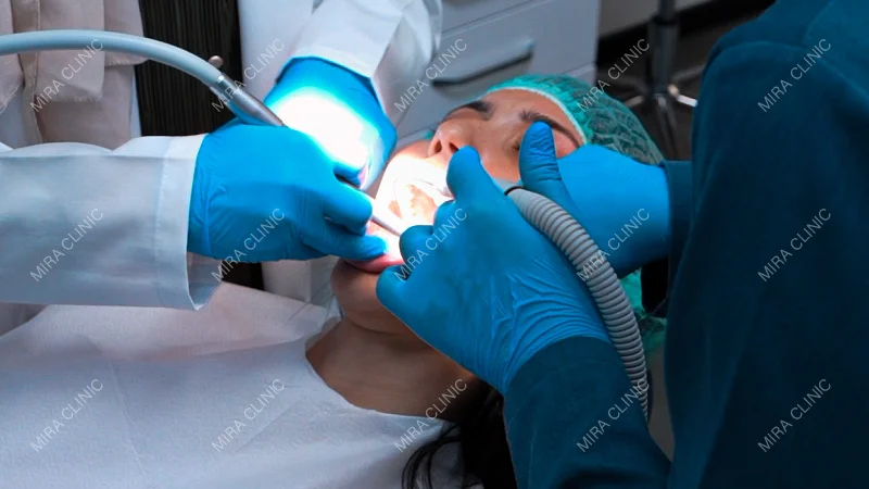 Hollywood Smile Procedure